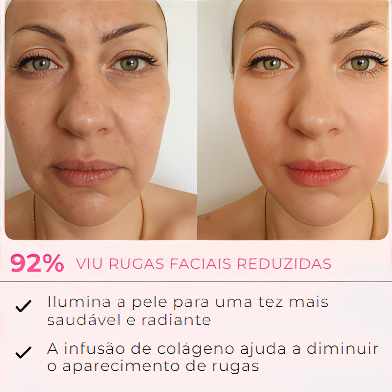MaskLifting - Retire Imperfeições Faciais | COMPRE 1 LEVE 4 PACOTES | TRATAMENTO COMPLETO + Frete Grátis