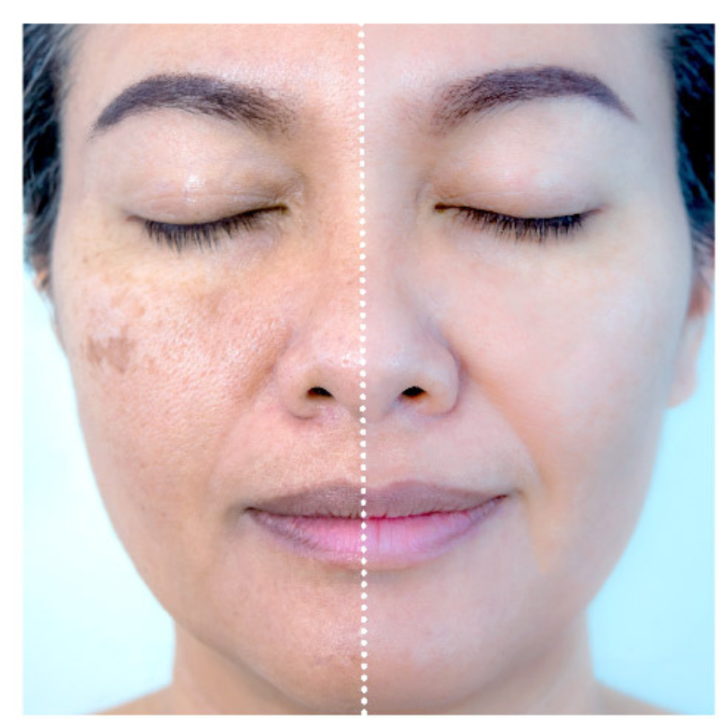 KIT 10 UNIDADES Máscaras CollagenBoost - ATIVOS DO BOTOX | Frete Grátis