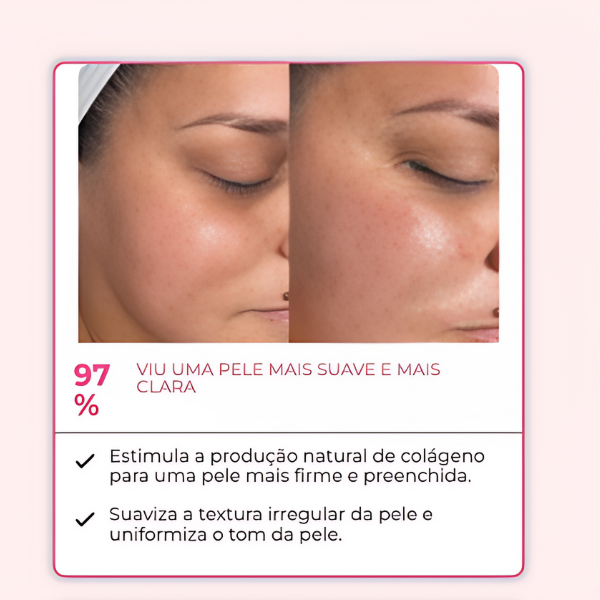 KIT RENEW 3 AMPOLAS | PROMOÇÃO ESPECIAL