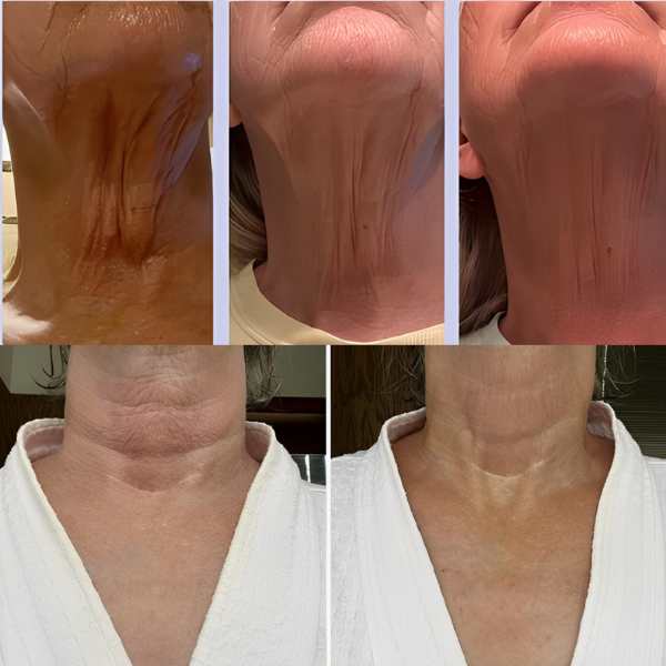 Creme LiftNeck - Revitalize sua Pele | COMPRE 1 LEVE 2 | Frete Grátis